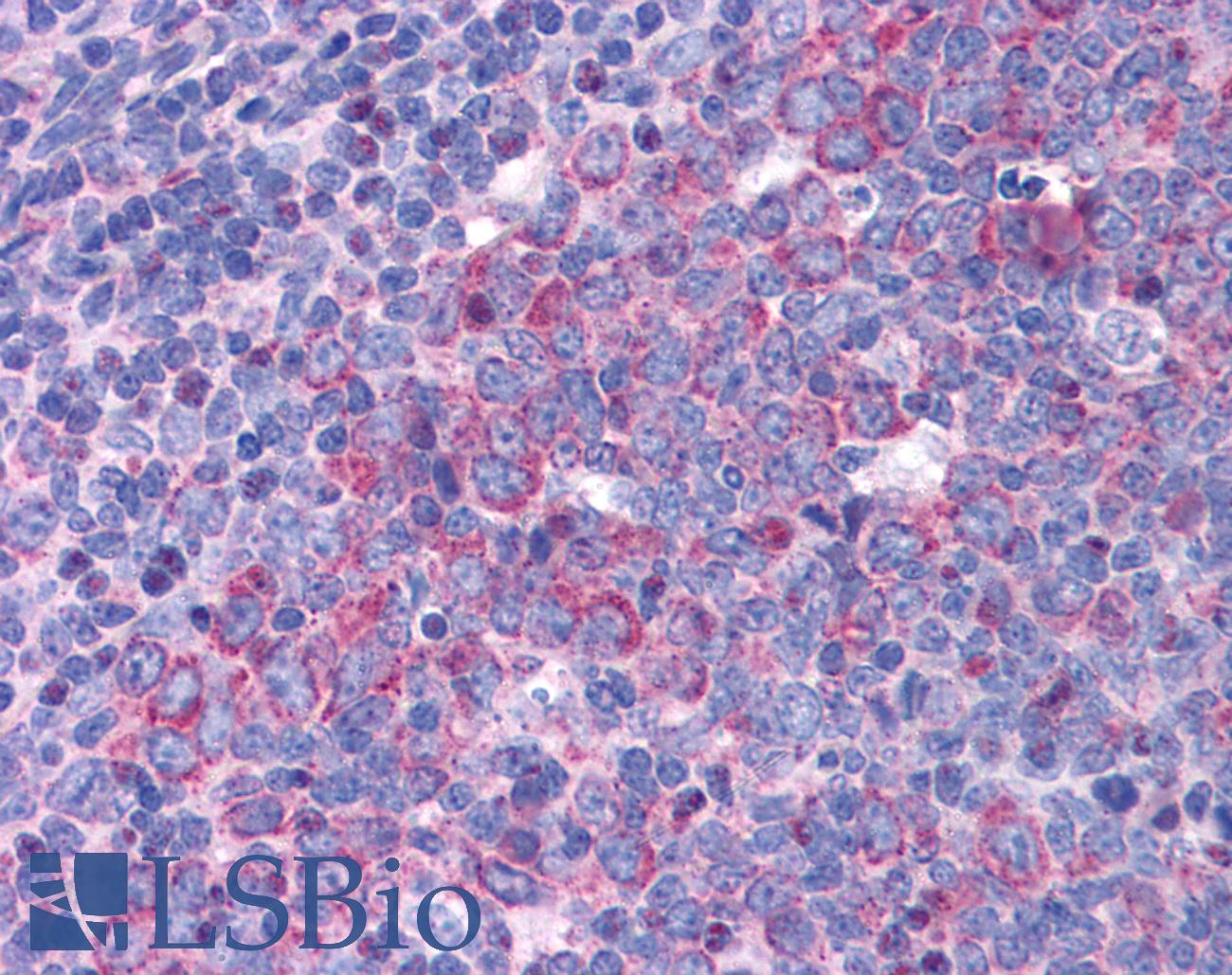 EIF5A Antibody - Anti-EIF5A antibody IHC of human tonsil. Immunohistochemistry of formalin-fixed, paraffin-embedded tissue after heat-induced antigen retrieval. Antibody concentration 3.75 ug/ml.