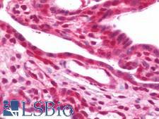 EIF5A2 Antibody - Anti-EIF5A2 antibody IHC staining of human placenta. Immunohistochemistry of formalin-fixed, paraffin-embedded tissue after heat-induced antigen retrieval. Antibody dilution 1:50.