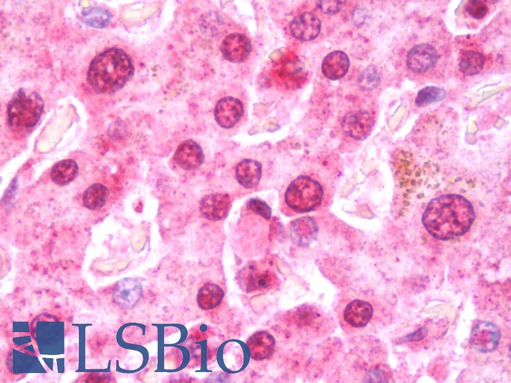 EIF5A2 Antibody - Anti-EIF5A2 antibody IHC staining of human liver. Immunohistochemistry of formalin-fixed, paraffin-embedded tissue after heat-induced antigen retrieval. Antibody concentration 7.5 ug/ml.