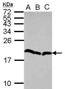 EIF5A2 Antibody - Sample (30 ug of whole cell lysate) A: 293T B: A431 C: HeLa 15% SDS PAGE eIF5A2 antibody diluted at 1:1000