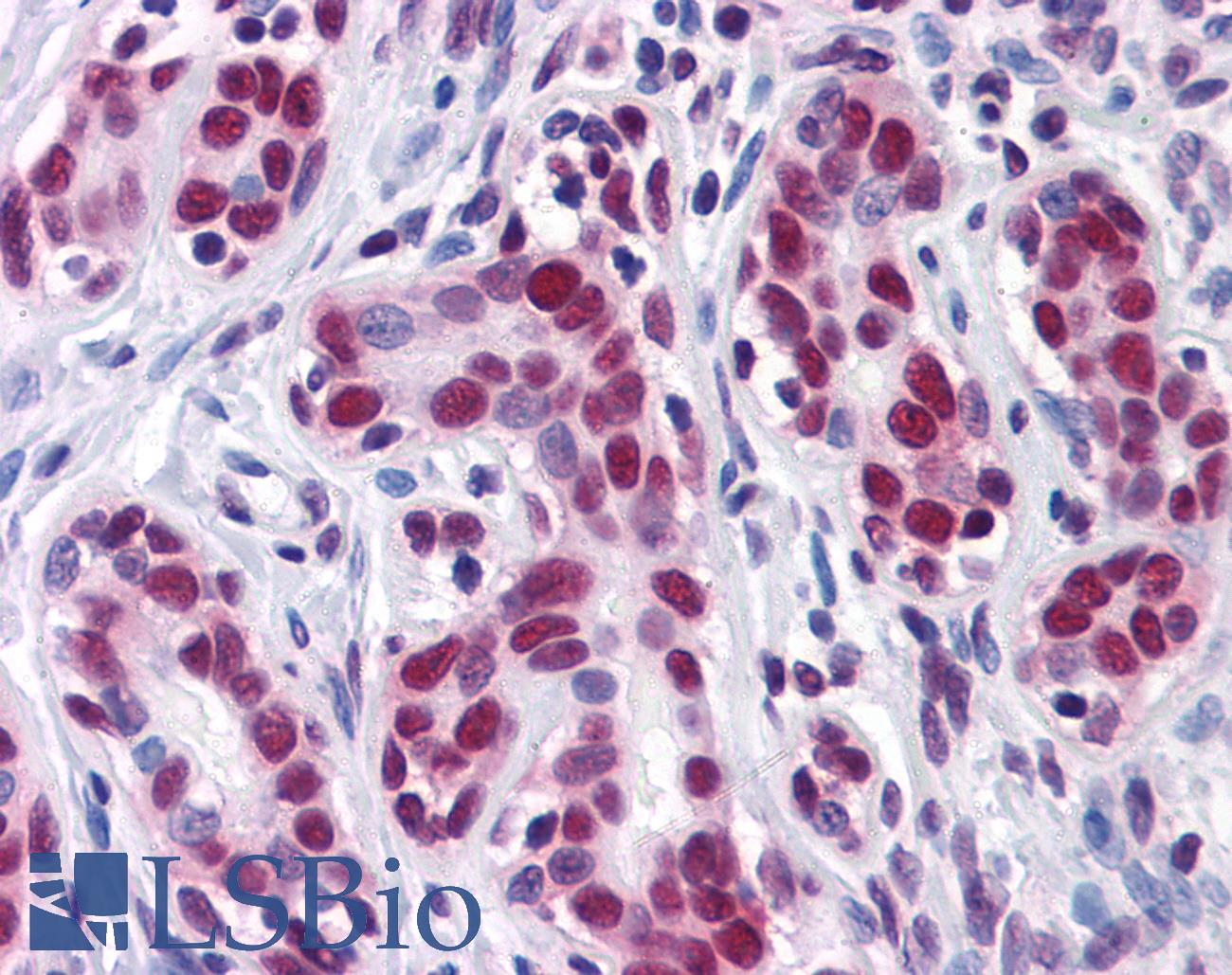 ELAVL1 / HUR Antibody - Anti-HuR antibody IHC of human breast. Immunohistochemistry of formalin-fixed, paraffin-embedded tissue after heat-induced antigen retrieval. Antibody concentration 10 ug/ml.