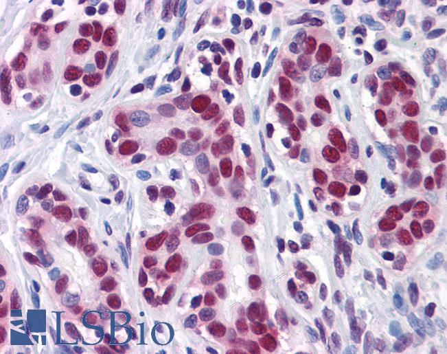 ELAVL1 / HUR Antibody - Anti-HuR antibody IHC of human breast. Immunohistochemistry of formalin-fixed, paraffin-embedded tissue after heat-induced antigen retrieval. Antibody concentration 10 ug/ml.