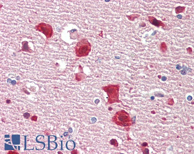 ELAVL2 / HUB Antibody - Anti-ELAVL2 / HUB antibody IHC staining of human brain, cortex. Immunohistochemistry of formalin-fixed, paraffin-embedded tissue after heat-induced antigen retrieval. Antibody dilution 1:100.