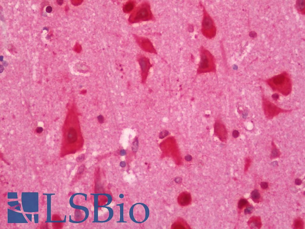 ELAVL2 / HUB Antibody - Human Brain, Cortex: Formalin-Fixed, Paraffin-Embedded (FFPE).  This image was taken for the unconjugated form of this product. Other forms have not been tested.
