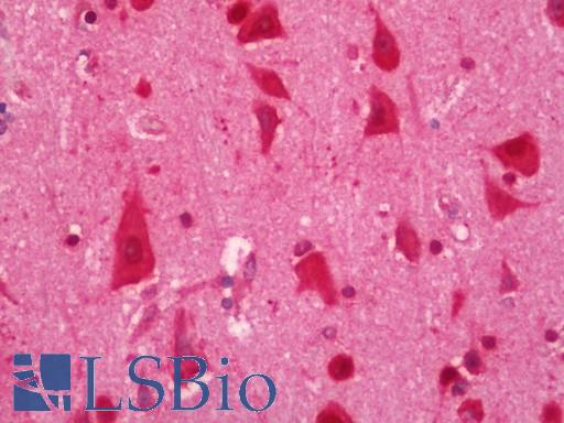 ELAVL2 / HUB Antibody - Human Brain, Cortex: Formalin-Fixed, Paraffin-Embedded (FFPE).  This image was taken for the unconjugated form of this product. Other forms have not been tested.