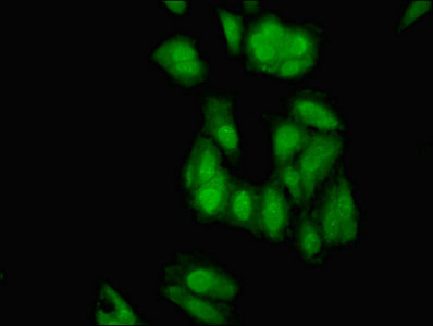 ELAVL2 / HUB Antibody - Immunofluorescent analysis of Hela cells using ELAVL2 Antibody at dilution of 1:100 and Alexa Fluor 488-congugated AffiniPure Goat Anti-Rabbit IgG(H+L)