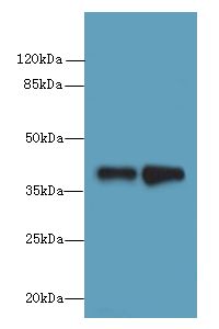 ELAVL4 / HuD Antibody - Western blot. All lanes: ELAVL4 antibody at 2 ug/ml. Lane 1: MCF7 whole cell lysate. Lane 2: 293T whole cell lysate. Secondary Goat polyclonal to Rabbit IgG at 1:10000 dilution. Predicted band size: 42 kDa. Observed band size: 42 kDa.