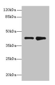 ELAVL4 / HuD Antibody - Western blot All lanes: ELAVL4 antibody at 2µg/ml Lane 1: MCF-7 whole cell lysate Lane 2: 293T whole cell lysate Secondary Goat polyclonal to rabbit IgG at 1/10000 dilution Predicted band size: 42, 41, 43 kDa Observed band size: 42 kDa