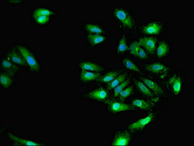 ELAVL4 / HuD Antibody - Immunofluorescent analysis of Hela cells using ELAVL4 Antibody at dilution of 1:100 and Alexa Fluor 488-congugated AffiniPure Goat Anti-Rabbit IgG(H+L)