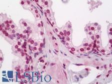 ELF5 Antibody - Anti-ELF5 antibody IHC staining of human prostate. Immunohistochemistry of formalin-fixed, paraffin-embedded tissue after heat-induced antigen retrieval. Antibody dilution 1:50.