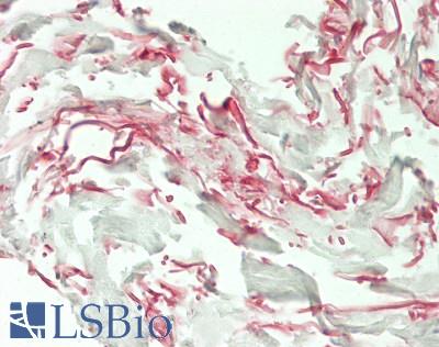 ELN / Elastin Antibody - Human Skin, Dermal Elastin: Formalin-Fixed, Paraffin-Embedded (FFPE)