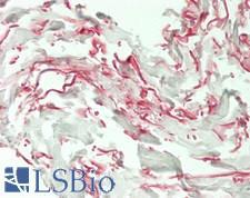 ELN / Elastin Antibody - Human Skin, Dermal Elastin: Formalin-Fixed, Paraffin-Embedded (FFPE)