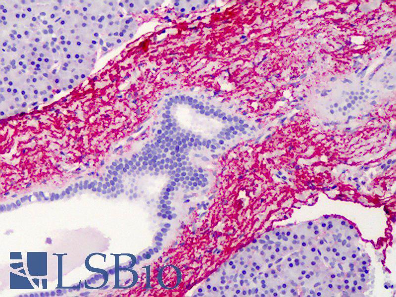 ELN / Elastin Antibody - Anti-Elastin antibody IHC of human pancreas. Immunohistochemistry of formalin-fixed, paraffin-embedded tissue after heat-induced antigen retrieval. Antibody concentration 2.5 ug/ml.