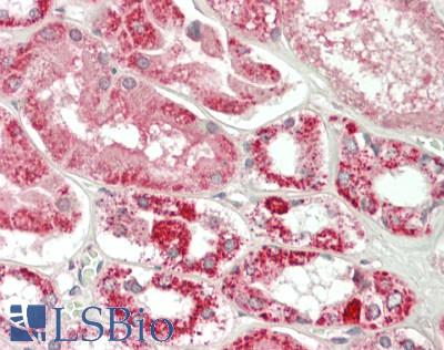 ELOVL1 Antibody - Human Kidney: Formalin-Fixed, Paraffin-Embedded (FFPE)