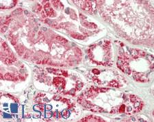 ELOVL1 Antibody - Human Kidney: Formalin-Fixed, Paraffin-Embedded (FFPE)