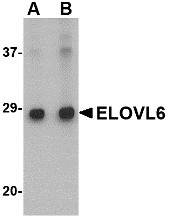ELOVL6 Antibody - Western blot of ELOVL6 in Human brain tissue lysate with ELOVL6 antibody at (A) 1 and (B) 2 ug/ml.