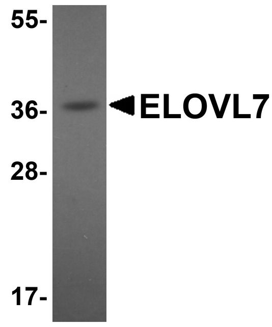 ELOVL7 Antibody - Western blot analysis of ELOVL7 in human liver tissue lysate with ELOVL7 antibody at 1 ug/ml.