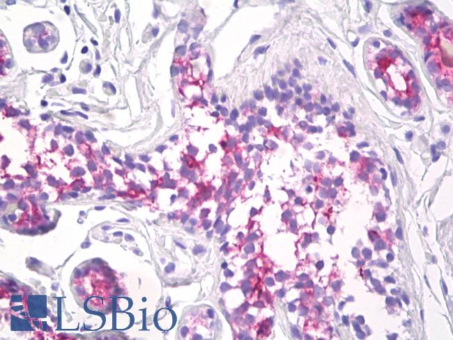 EMA / MUC1 Antibody - Anti-MUC1 antibody IHC of human breast. Immunohistochemistry of formalin-fixed, paraffin-embedded tissue after heat-induced antigen retrieval. Antibody dilution 10 ug/ml.