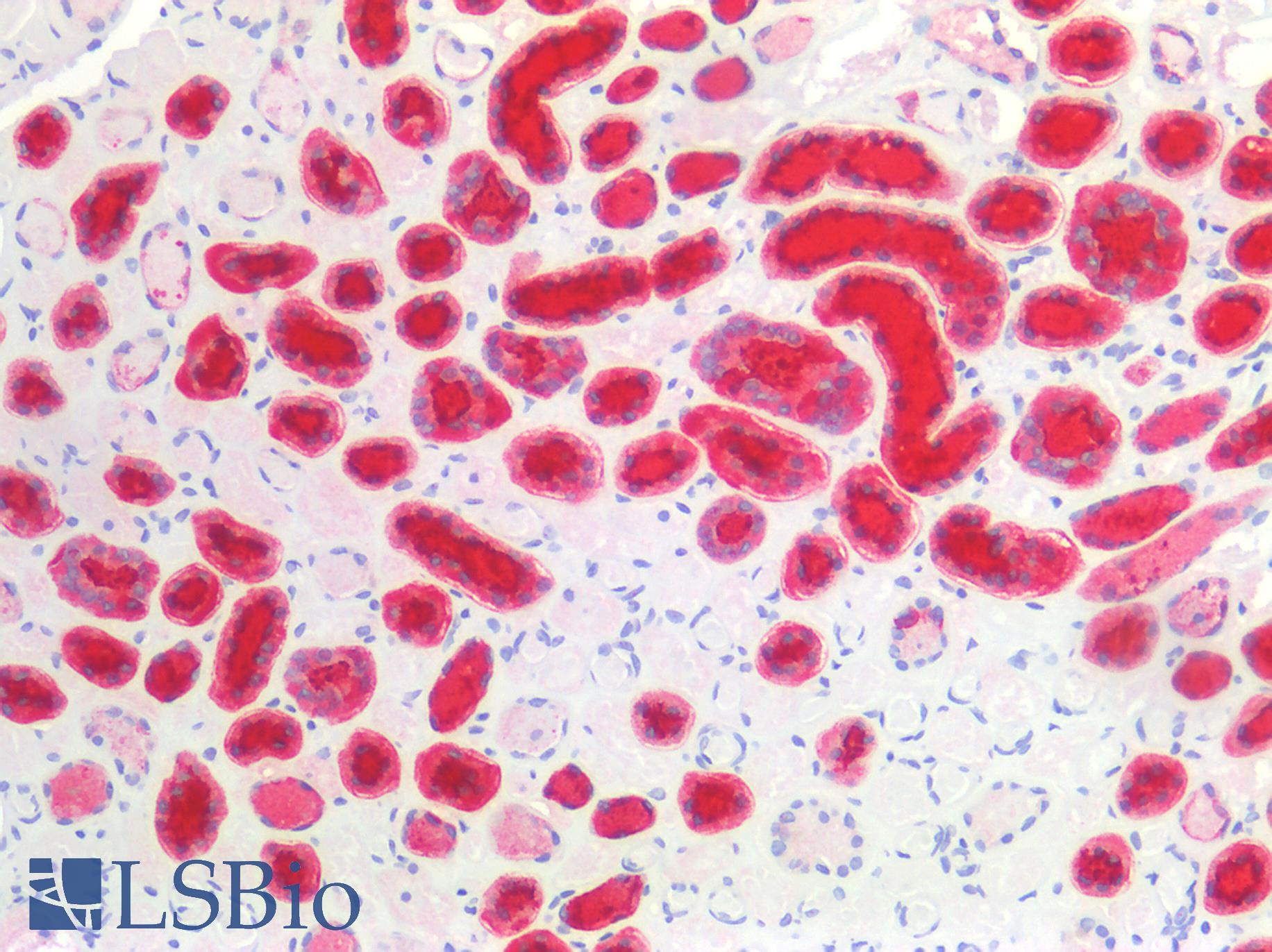 EMA / MUC1 Antibody - Human Kidney: Formalin-Fixed, Paraffin-Embedded (FFPE)