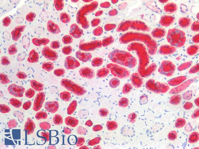 EMA / MUC1 Antibody - Human Kidney: Formalin-Fixed, Paraffin-Embedded (FFPE)