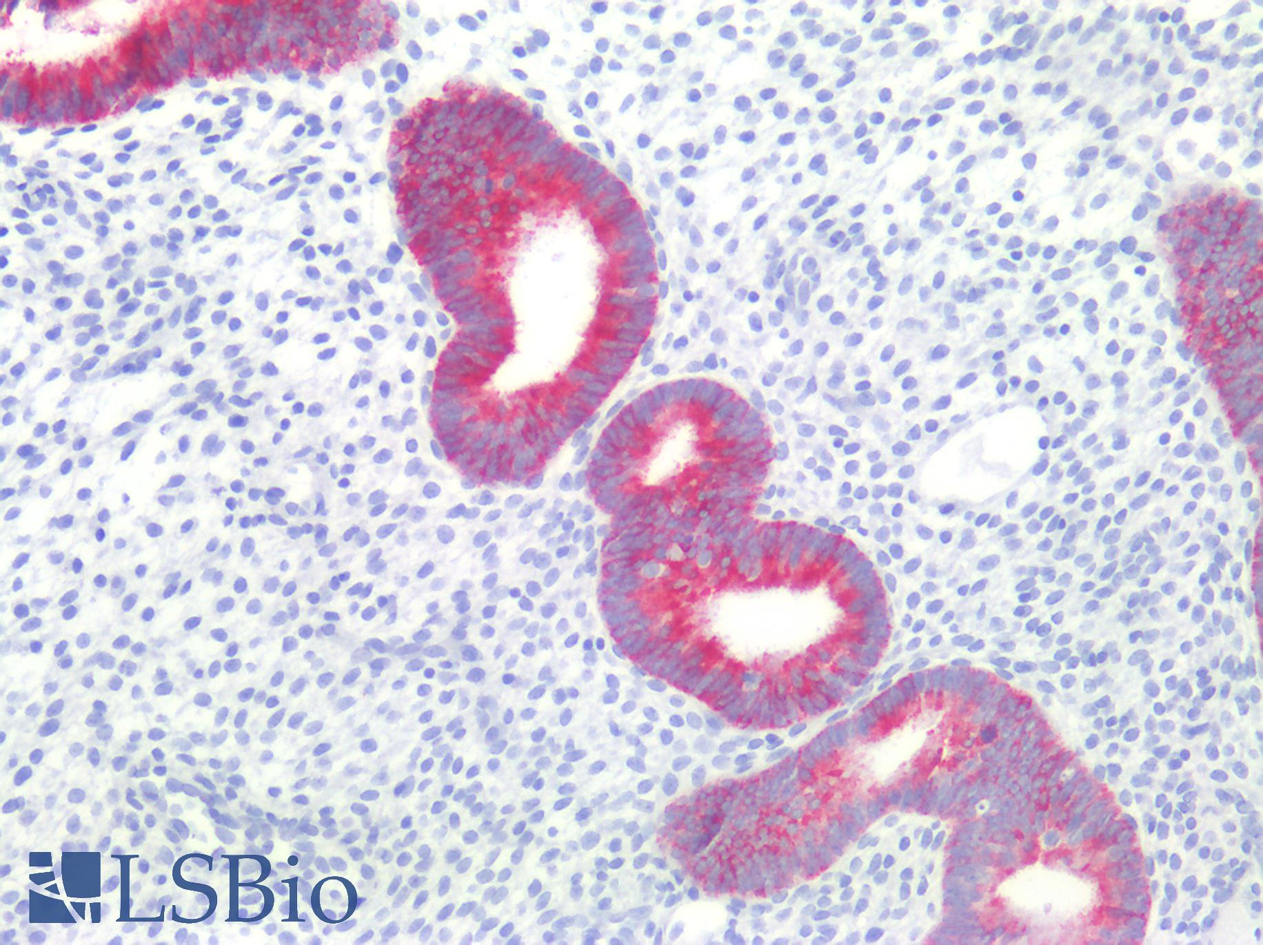 EMA / MUC1 Antibody - Human Uterus: Formalin-Fixed, Paraffin-Embedded (FFPE)