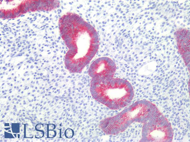 EMA / MUC1 Antibody - Human Uterus: Formalin-Fixed, Paraffin-Embedded (FFPE)