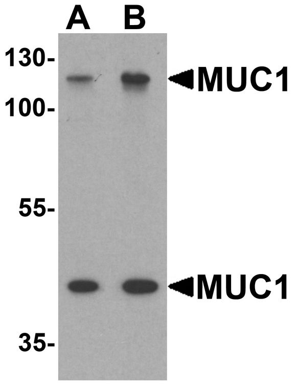 EMA / MUC1 Antibody - Western blot analysis of MUC1 in HeLa cell lysate with MUC1 antibody at (A) 1 and (B) 2 ug/ml.