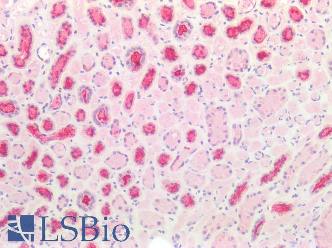 EMA / MUC1 Antibody - Human Kidney: Formalin-Fixed, Paraffin-Embedded (FFPE)