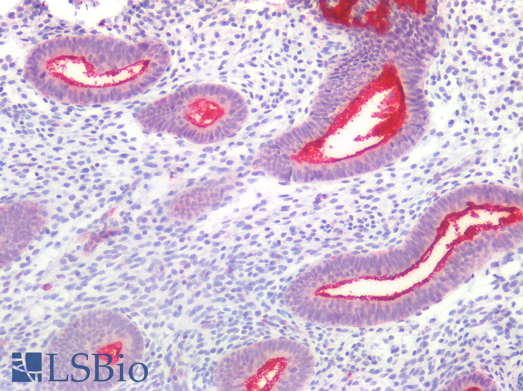 EMA / MUC1 Antibody - Human Uterus: Formalin-Fixed, Paraffin-Embedded (FFPE)