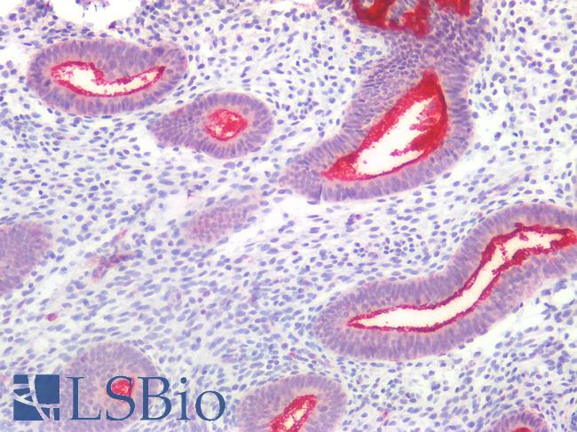 EMA / MUC1 Antibody - Human Uterus: Formalin-Fixed, Paraffin-Embedded (FFPE)