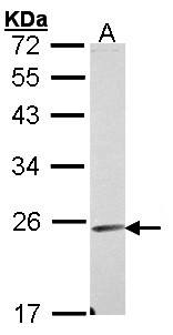 EMCN / Endomucin Antibody - Sample (30 ug of whole cell lysate). A: A431 . 12% SDS PAGE. EMCN / Endomucin antibody diluted at 1:1000.