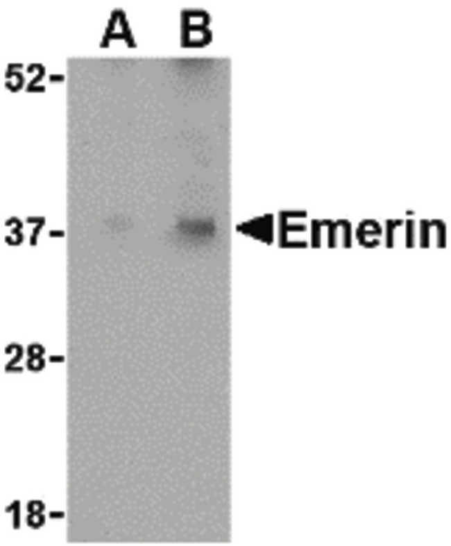 EMD / Emerin Antibody - Western blot of Emerin in human skeletal muscle tissue lysate with Emerin antibody at (A) 0.5 and (B) 1 ug/ml.