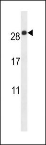 EMP2 Antibody - EMP2 Antibody western blot of mouse lung tissue lysates (35 ug/lane). The EMP2 antibody detected the EMP2 protein (arrow).
