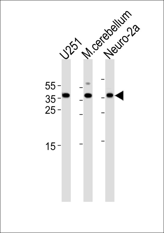EMX1 Antibody - EMX1 Antibody western blot of U251 and Neuro-2a cell line mouse cerebellum tissue lysates (35 ug/lane). The EMX1 antibody detected the EMX1 protein (arrow).