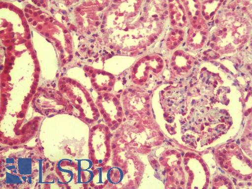 EMX1 Antibody - Anti-EMX1 antibody IHC staining of human kidney. Immunohistochemistry of formalin-fixed, paraffin-embedded tissue after heat-induced antigen retrieval. Antibody concentration 5 ug/ml.