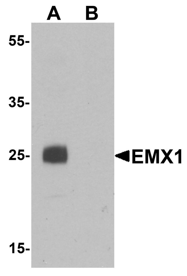 EMX1 Antibody - Western blot analysis of EMX1 in rat liver tissue lysate with EMX1 antibody at 1 ug/ml in (A) the absence and (B) the presence of blocking peptide.