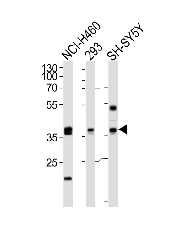 EN1 / Engrailed Antibody - Western blot of lysates from NCI-H460,293,SH-SY5Y cell line (from left to right),using EN1 Antibody. Antibody was diluted at 1:1000 at each lane. A goat anti-rabbit IgG H&L (HRP) at 1:5000 dilution was used as the secondary antibody.Lysates at 35ug per lane.