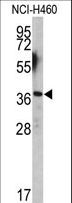 EN2 Antibody - Western blot of EN2 antibody (C-term-2) in NCI-H460 cell line lysates (35 ug/lane). EN2 (arrow) was detected using the purified antibody.