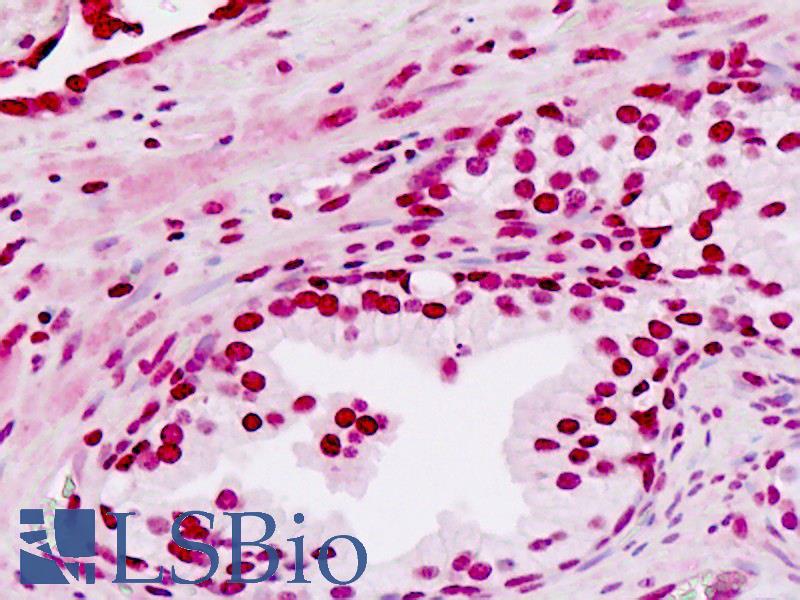 EN2 Antibody - Human Prostate: Formalin-Fixed, Paraffin-Embedded (FFPE)