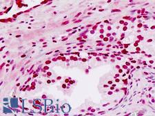 EN2 Antibody - Human Prostate: Formalin-Fixed, Paraffin-Embedded (FFPE)