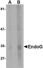 Endonuclease G / ENDOG Antibody - Western blot of EndoG expression in HepG2 cell lysate with EndoG antibody at (A) 5 and (B) 10 ug/ml.