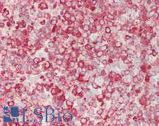 Endonuclease G / ENDOG Antibody - Human Spleen: Formalin-Fixed, Paraffin-Embedded (FFPE)
