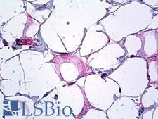 Endostatin Antibody - Anti-COL18A1 / Endostatin antibody IHC of human breast, collagen. Immunohistochemistry of formalin-fixed, paraffin-embedded tissue after heat-induced antigen retrieval. Antibody dilution 1:100.