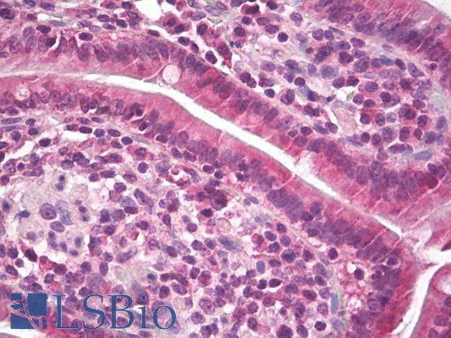 Endostatin Antibody - Anti-Endostatin antibody IHC of human small intestine. Immunohistochemistry of formalin-fixed, paraffin-embedded tissue after heat-induced antigen retrieval. Antibody dilution 5 ug/ml.