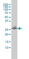 Endothelin 3 / EDN3 Antibody - EDN3 monoclonal antibody (M01), clone 2A6-2A4 Western Blot analysis of EDN3 expression in LNCaP.