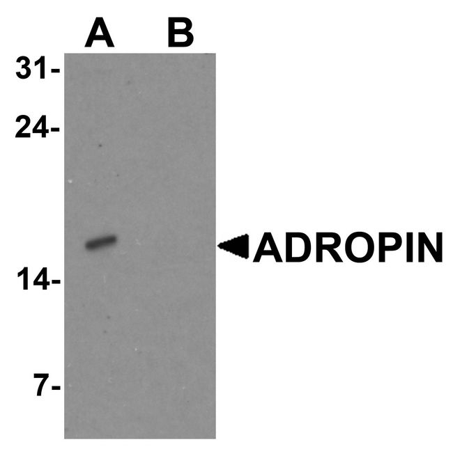 ENHO / Adropin Antibody - Western blot analysis of ADROPIN in human brain tissue lysate with ADROPIN antibody at 2 ug/ml in (A) the absence and (B) the presence of blocking peptide.