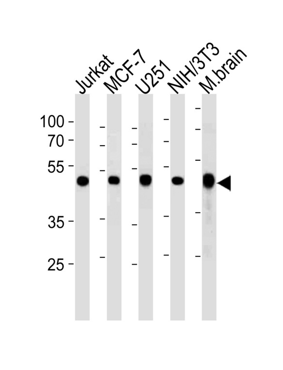 ENO1 / Alpha Enolase Antibody - ENO1 Antibody western blot of Jurkat,MCF-7,U251,mouse NIH/3T3 cell line and mouse brain tissue lysates (35 ug/lane). The ENO1 antibody detected the ENO1 protein (arrow).