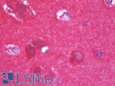 ENO2 / NSE Antibody - Anti-ENO2 / NSE antibody IHC staining of human brain, cortex. Immunohistochemistry of formalin-fixed, paraffin-embedded tissue after heat-induced antigen retrieval. Antibody dilution 1:500.