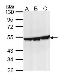 ENO3 / Enolase 3 Antibody - Sample (30 ug of whole cell lysate). A: Hep G2 , B: Molt-4 , C: Raji. 10% SDS PAGE. ENO3 / Enolase 3 antibody diluted at 1:1000.
