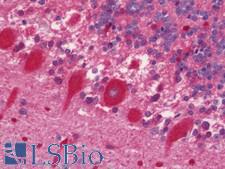 ENO3 / Enolase 3 Antibody - Anti-ENO3 / Enolase 3 antibody IHC staining of human brain, cerebellum. Immunohistochemistry of formalin-fixed, paraffin-embedded tissue after heat-induced antigen retrieval. Antibody concentration 7.5 ug/ml.